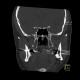Accessory salivary gland, Stafne's defect: CT - Computed tomography